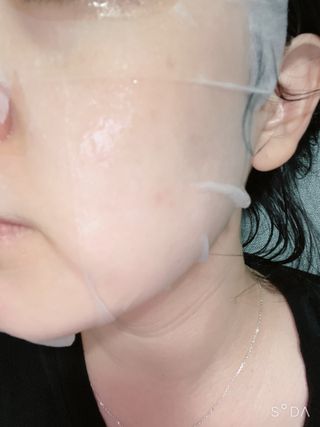 에이스노 레스큐 부스트 하이드레이션 시트마스크 — 4점을 준 리뷰어가 2021년 10월 올린 사용 사진