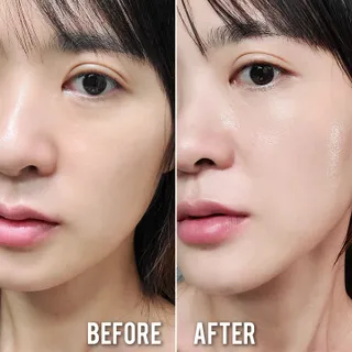 베지톨로지 비니페린 브라이트닝 앰플 — 5점을 준 리뷰어가 2022년 9월 올린 사용 사진