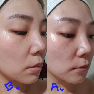 이지듀 RX 센시티브 베리어 카밍크림 — 5점을 준 리뷰어가 2021년 6월 올린 사용 사진
