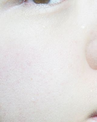 셀바이져 지우개 미스트 피부 보호 입주변 트러블 진정 케어 아기 안개분사 미스트 — 5점을 준 리뷰어가 2021년 2월 올린 사용 사진