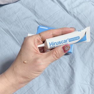 히루스카 포스트아크네 클리어 — 5점을 준 리뷰어가 2021년 2월 올린 사용 사진