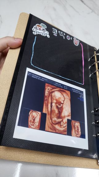 콩딱맘👶🏻님이 올린 리뷰 사진 4