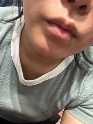 [올리브영] 웰더마 프리미엄 레티놀 콜라겐 리프팅 리스토어 피팅마스크 4매 — 5점을 준 리뷰어가 2025년 7월 올린 사용 사진