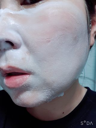 에스투엔디 바이오 포피 무스 트리트먼트 — 5점을 준 리뷰어가 2021년 5월 올린 사용 사진