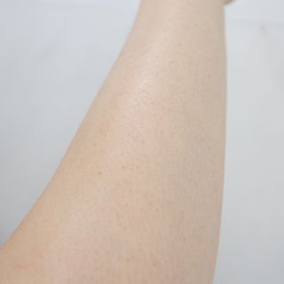 ★스마트 스토어 [올바이오] 더마크림 라이트 크림 130ml 저자극 보습 가려움개선 — 5점을 준 리뷰어가 2025년 1월 올린 사용 사진