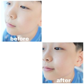 건선/아토/습진/민감성 피부 천연보습진정크림 소리온 크림 & 센시티브 크림 50g — 5점을 준 리뷰어가 2022년 3월 올린 사용 사진