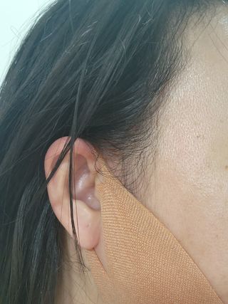 아이디플라코스메틱 아이디 페이스핏 마이너스 밴드 v2 — 5점을 준 리뷰어가 2022년 5월 올린 사용 사진