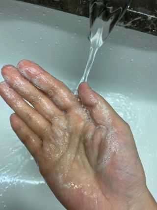 건선/아토피/트러블 두피 각질 케어 소리온 샴푸&플루이드 Shampoo & Fluid — 4점을 준 리뷰어가 2022년 3월 올린 사용 사진