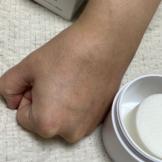 오투에니원 화이트 스완 갈락토미세스 비타민 C 필링 패드 60매 — 5점을 준 리뷰어가 2023년 1월 올린 사용 사진