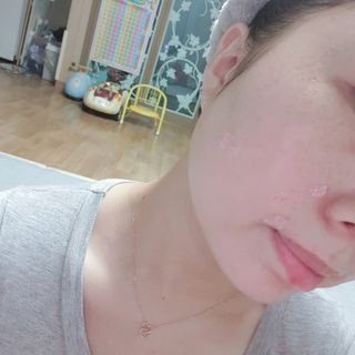 [유니자르] 엘라스틴 저분자 콜라겐95 + 칼라민 100 — 4점을 준 리뷰어가 2021년 11월 올린 사용 사진