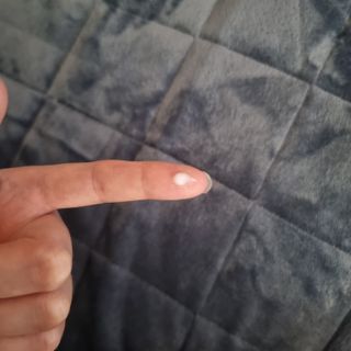 소담스퀘어 상암 닥터505 센텔라스카 연고 피톤치드(15g) — 5점을 준 리뷰어가 2022년 11월 올린 사용 사진
