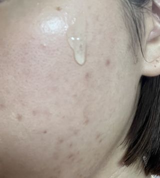 디에이브 더마-테카 바이옴 세럼 50ml — 5점을 준 리뷰어가 2023년 3월 올린 사용 사진