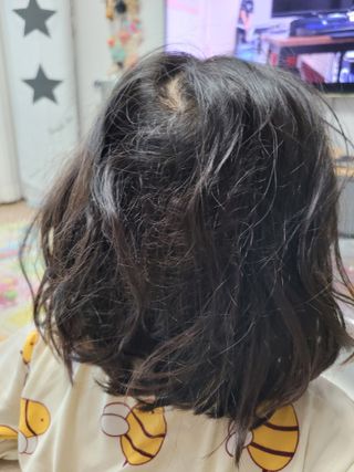 썸헤어 / SUMHAIR 썸헤어 헤어링 앰플 2종 중 택1 — 5점을 준 리뷰어가 2021년 5월 올린 사용 사진