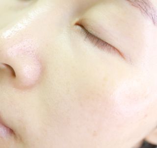 플레라디 에델바이스 오일 밸런싱 토너 — 5점을 준 리뷰어가 2021년 7월 올린 사용 사진