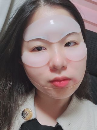 아이디플라코스메틱 아이디 페이스핏 플러스 패치 v2 — 5점을 준 리뷰어가 2020년 12월 올린 사용 사진