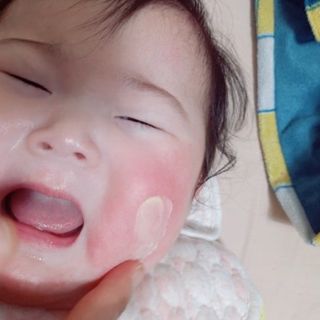 건선/아토/습진/민감성 피부 천연보습진정크림 소리온 크림 & 센시티브 크림 50g — 5점을 준 리뷰어가 2022년 2월 올린 사용 사진