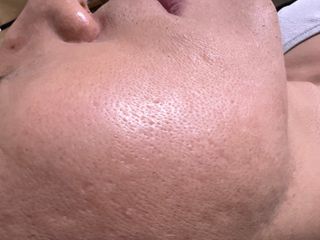 스킨큐어 산다화 비타민c 화이트닝 에센스 30ml — 5점을 준 리뷰어가 2023년 12월 올린 사용 사진
