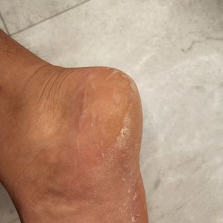 짱채맘님이 올린 리뷰 사진 2