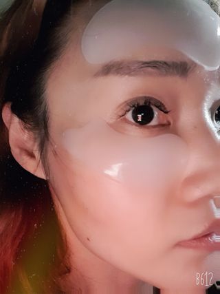아이디플라코스메틱 아이디 페이스핏 플러스 패치 v2 — 5점을 준 리뷰어가 2020년 12월 올린 사용 사진
