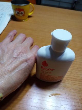 바이오오일 [바이오-오일] 바디 로션 175ml — 5점을 준 리뷰어가 2021년 12월 올린 사용 사진