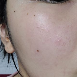 약손명가코스메틱 심결 깨어나는 맑음 팩 — 2.5점을 준 리뷰어가 2021년 3월 올린 사용 사진