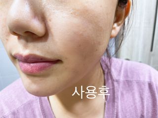 [후르디아] 약산성  모공 필링 패드(70매) — 5점을 준 리뷰어가 2021년 7월 올린 사용 사진