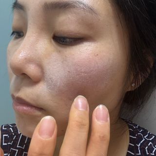 하이브리온 [쿠팡]멜라제로 시카엑소좀 크림 50ml PDRN 줄기세포 주름 미백기능성 피부과 병원입점, 1개, 50g — 5점을 준 리뷰어가 2025년 7월 올린 사용 사진