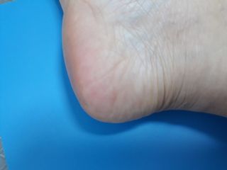 미라클풋 유리발각질제거기 물없이 쓱싹쓱싹 몇번만에 발각질 완벽제거 — 4.5점을 준 리뷰어가 2021년 9월 올린 사용 사진