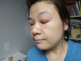 체르엠 스템앤셀 비타민 브라이트닝 에센스 30ml 1개 — 5점을 준 리뷰어가 2021년 9월 올린 사용 사진