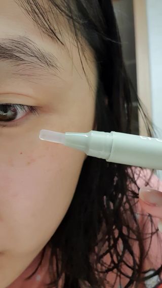 플리프 시카 알로에 스팟키트 — 5점을 준 리뷰어가 2021년 3월 올린 사용 사진