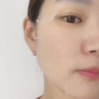 세뚜아(Cettua) 세뚜아 스팟 클리어 듀얼 패치 Cettua Spot Clear Dual Patch — 5점을 준 리뷰어가 2023년 7월 올린 사용 사진
