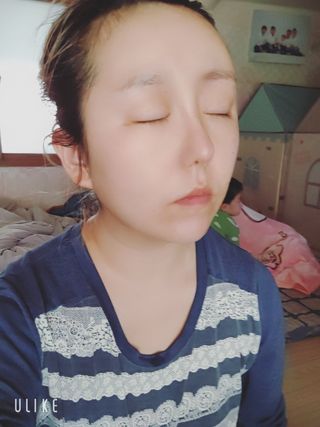 아이디플라코스메틱 페이스핏 플라스터 마스크 _ 리뉴얼 — 5점을 준 리뷰어가 2020년 12월 올린 사용 사진