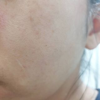 애디팬더 미생물 바이오 SF앰플 블루/그린 — 4.5점을 준 리뷰어가 2021년 5월 올린 사용 사진