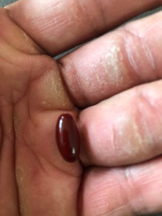 메디타민 루테인 지아잔틴 아스타잔틴 — 5점을 준 리뷰어가 2021년 11월 올린 사용 사진