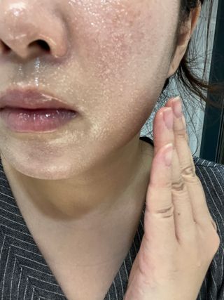 스킨1004 [SKIN1004] 마다가스카르 센텔라 라이트 클렌징 오일 200ml — 5점을 준 리뷰어가 2024년 8월 올린 사용 사진
