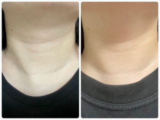 리더스코스메틱 리더스 퍼스트 샷 에센스 스틱 2종 — 5점을 준 리뷰어가 2022년 3월 올린 사용 사진