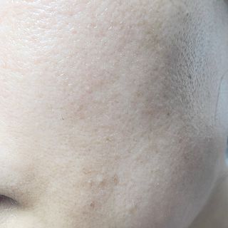 피터앤랩스 나이아신아마이드 5퍼센트 솔루션 위드 알란토인 — 4.5점을 준 리뷰어가 2021년 5월 올린 사용 사진