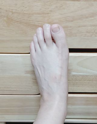 [큐어반H 커팅] 간편하게 떼서 쓰는 자외선차단 습윤밴드 (1팩/30매입) — 5점을 준 리뷰어가 2022년 11월 올린 사용 사진