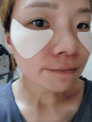 원에이드 알로에사포나리아 투명 골프패치 & 원에이드 하이드로겔 스포츠패치 — 5점을 준 리뷰어가 2022년 8월 올린 사용 사진