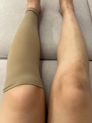 시그바리스 다이나벤 의료용 압박 스타킹 [종아리형] 여름철 다리 붓기 관리 하지정맥류 예방 — 5점을 준 리뷰어가 2024년 8월 올린 사용 사진