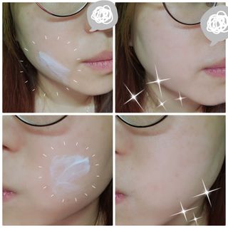 젠바이오 코스메틱스 젠바이오수딩크림]   가려운 피부 & 아토피 원픽 크림 — 5점을 준 리뷰어가 2022년 7월 올린 사용 사진