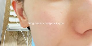세뚜아(Cettua) 세뚜아 스티키 포어 패치 Cettua Sticky Pore Patch — 4.5점을 준 리뷰어가 2023년 8월 올린 사용 사진