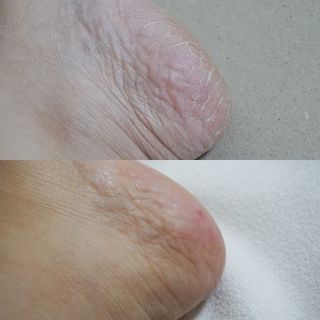 미라클풋 유리발각질제거기 물없이 쓱싹쓱싹 몇번만에 발각질 완벽제거 — 5점을 준 리뷰어가 2021년 10월 올린 사용 사진