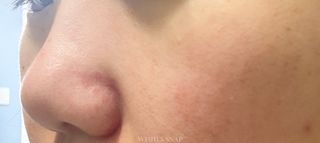 나우 [리브엠] 화해 1등 수분앰플 , 엑소코어 워터풀 텐션 앰플 — 5점을 준 리뷰어가 2025년 3월 올린 사용 사진