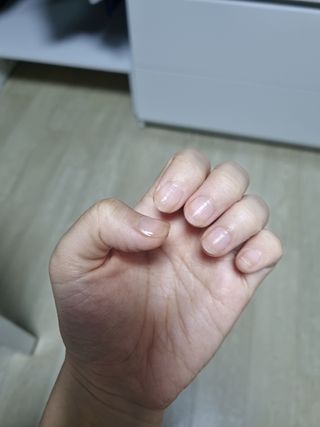 톱메드 free 더마 네일 컨디셔닝 세럼 — 5점을 준 리뷰어가 2023년 11월 올린 사용 사진