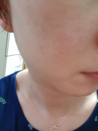 [NEW 탄력유턴 아이크림] AHC 유스 래스팅 리얼 아이크림 포 페이스 — 5점을 준 리뷰어가 2021년 3월 올린 사용 사진