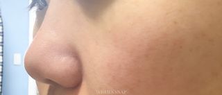 나우 [리브엠] 화해 1등 수분앰플 , 엑소코어 워터풀 텐션 앰플 — 5점을 준 리뷰어가 2025년 3월 올린 사용 사진