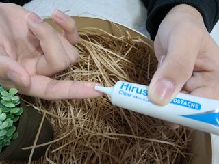 히루스카 포스트아크네 클리어 — 5점을 준 리뷰어가 2021년 1월 올린 사용 사진