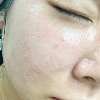스킨1004 [SKIN1004] 마다가스카르 센텔라 라이트 클렌징 오일 200ml — 4.5점을 준 리뷰어가 2024년 8월 올린 사용 사진
