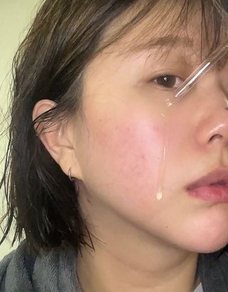 [스킨1004] 마다가스카르 센텔라 앰플 100ml — 5점을 준 리뷰어가 2024년 5월 올린 사용 사진